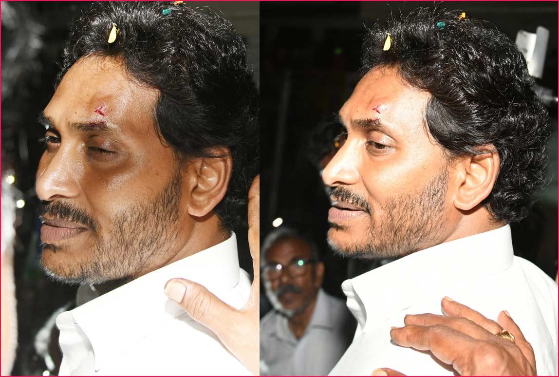 Intense reactions as stone pelter injures CM Jagan