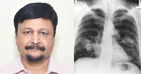 Indian Made X Ray To Detect Corona In 5 Seconds