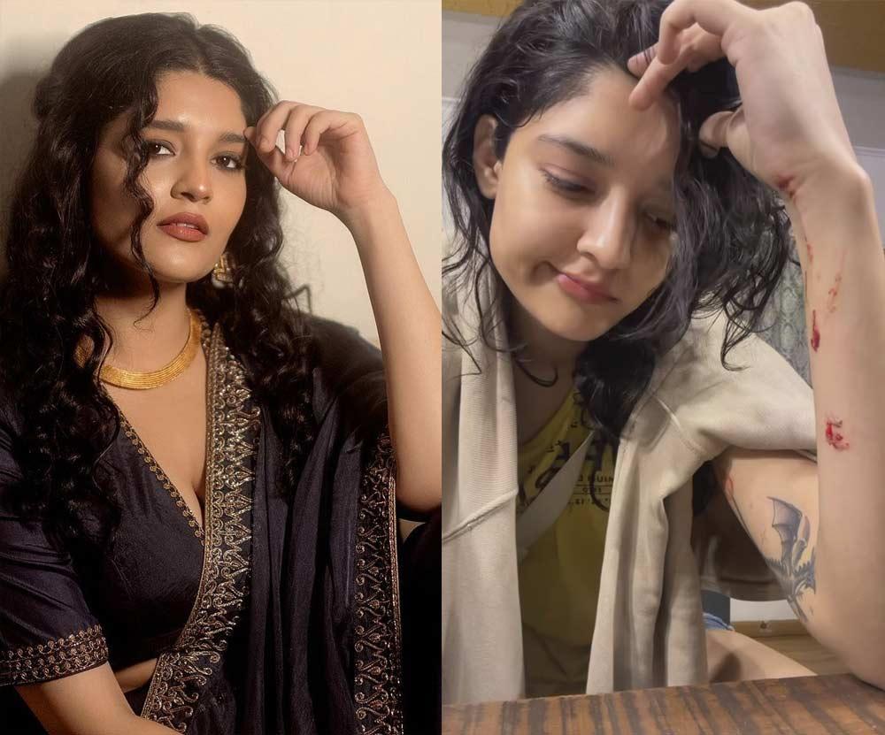 Ritika Singh injured during shoot
