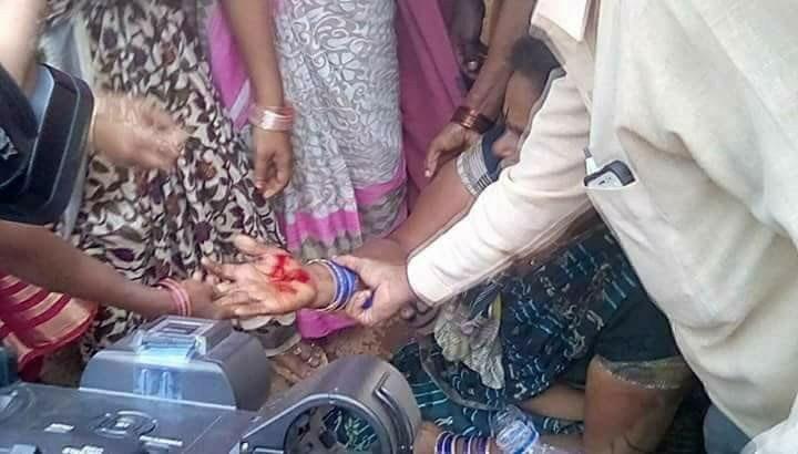 Social Activist Devi Should Focus on This Issue!