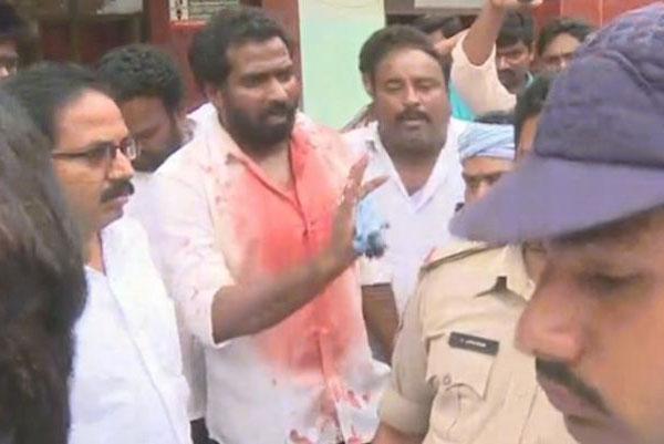 TDP, YSRCP Bloody Clashes