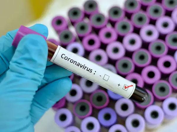 List Of Telangana Labs Permitted For COVID Tests