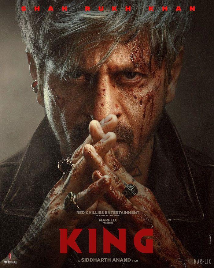 King Audio Rights