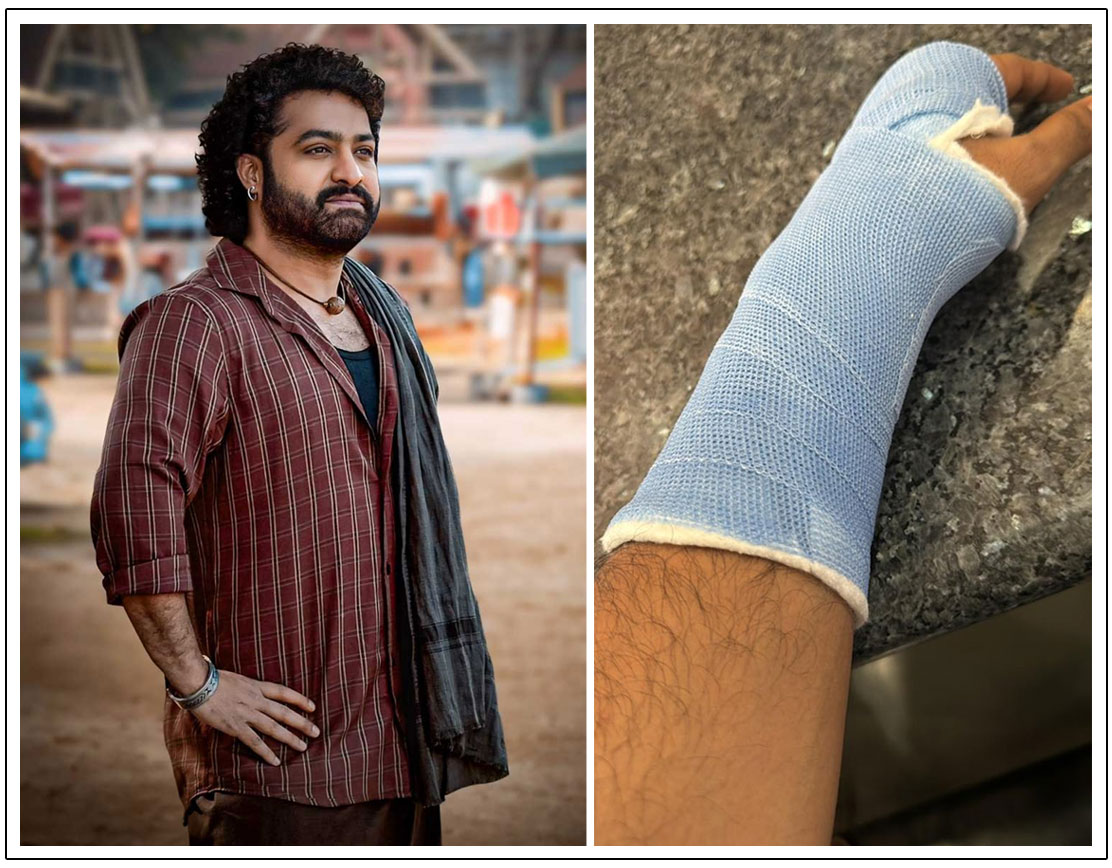 NTR suffering a minor wrist sprain