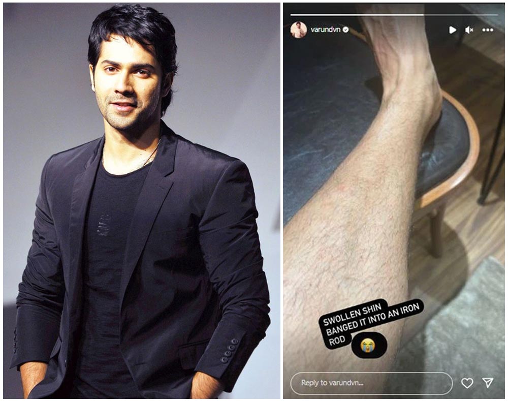  Varun Dhawan Injured In VD18 Sets