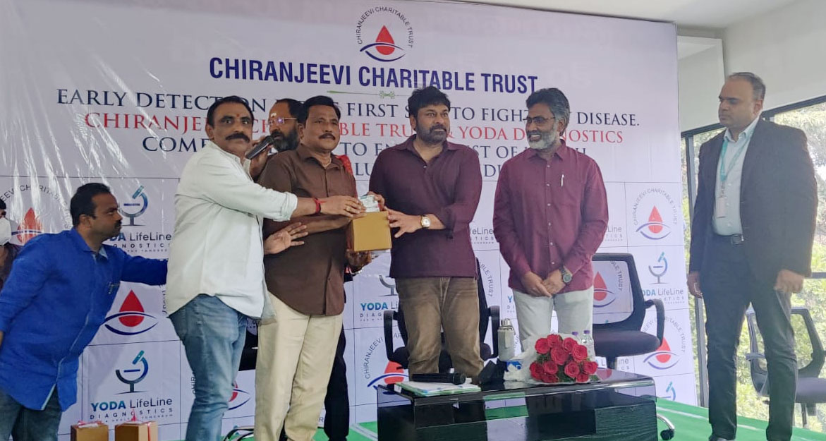 megastar chiranjeevi,megastar,chiranjeevi,yoda diagnostics,lifetime health cards,yoda diagnostics lifetime health cards  మెగాస్టార్ దానగుణంలో మరో మైలు రాయి 