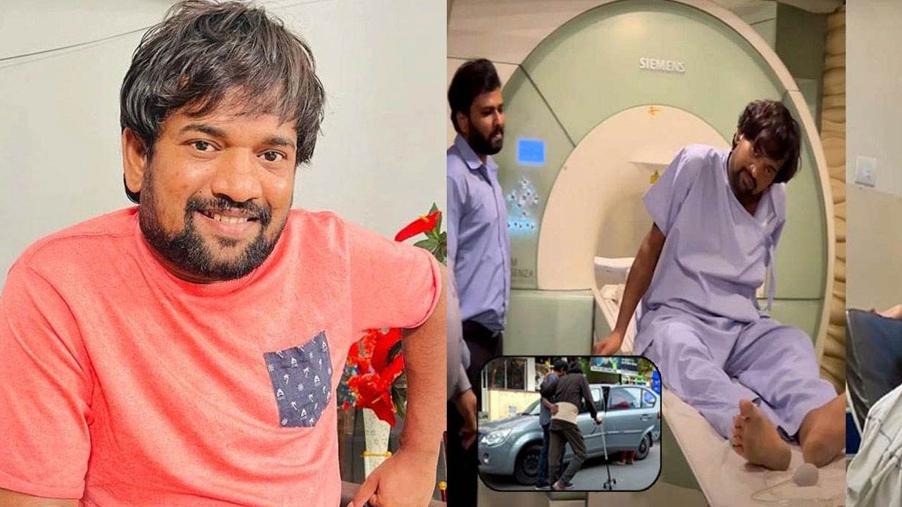 jabardasth,comedian punch prasad  జబర్దస్త్ పంచ్ ప్రసాద్ హెల్త్ అప్ డేట్ 