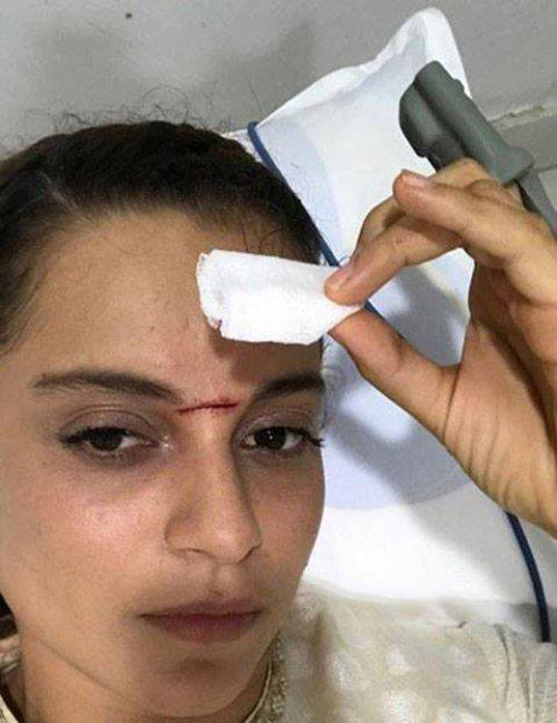 manikarnika,kangna ranaut,krish,sword fight,kangna injury  మణికర్ణిక కు కత్తి తగిలింది..!