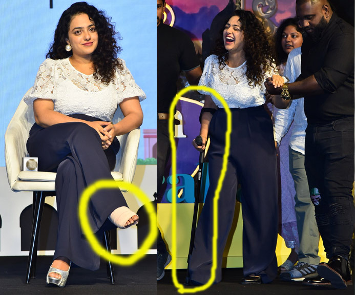 nithya menon,nithya menon leg fracture,modern love hyderabad web series trailer launch  మెట్లపై నుండి జారిపడిన హీరోయిన్ 