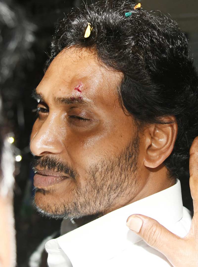 Stone Pelted On CM YS Jagan వైఎస్ జగన్ పై దాడి.. కంటికి గాయం!